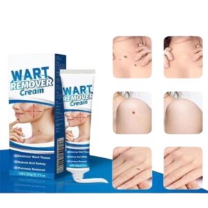 Warts Removal Cream 20g